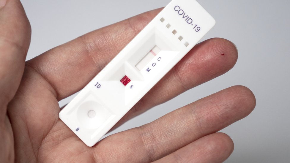 Centro de Triagem Covid-19 de Coruripe será desativado devido à baixa demanda